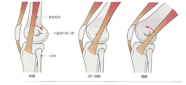 脛 ストレッチ 腸 靭帯 膝の外側に痛みが出る人は必見!腸脛靭帯炎の症状別の治し方